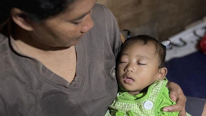 Kisah Pilu Wulan, Derita Glaukoma Sejak Lahir yang Butuh Uluran Tangan